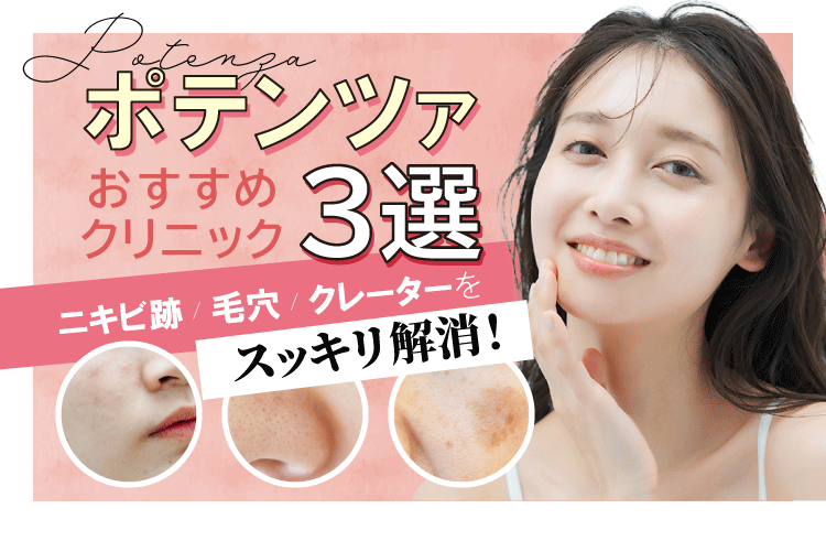 ポテンツァおすすめクリニック3選